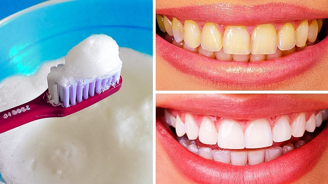 How to Whiten Your Teeth Safely A Comprehensive Guide e PC Media