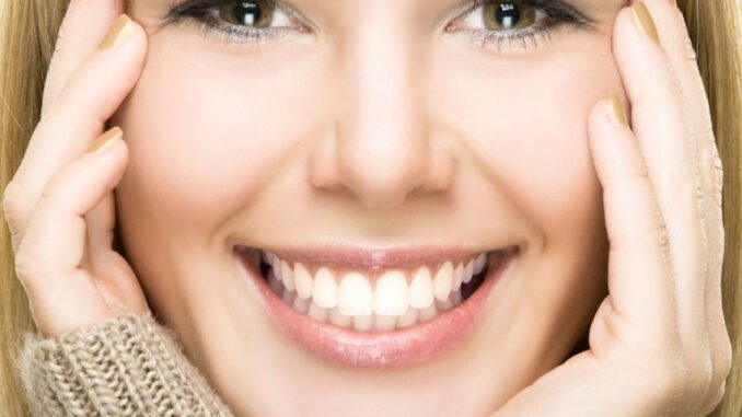 Guide on Achieving the Perfect Smile