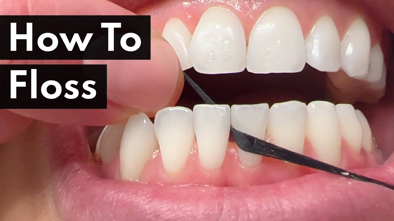 The Definitive Guide to Flossing Correctly: Techniques, Tips, and ...